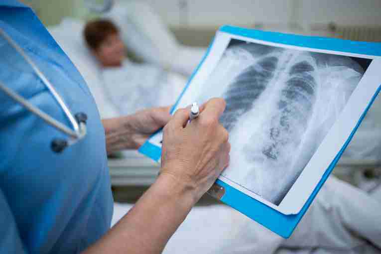 Атипичная пневмония в Казахстане: главный санврач Алматы объяснил ее происхождение